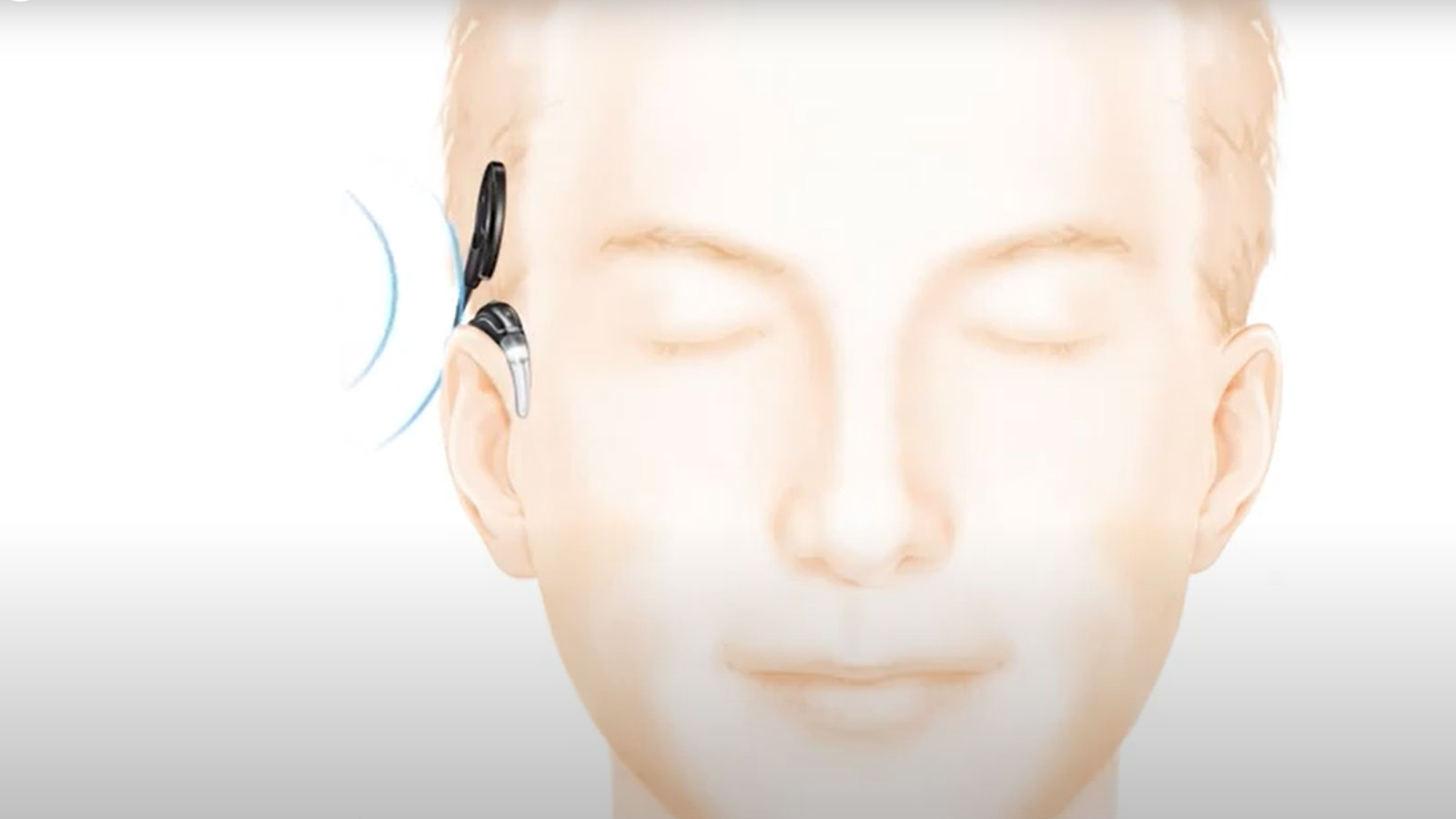 ja-JP_Nancho_How-cochlear-implants-work.jpg
