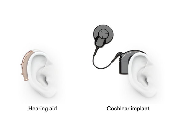 win-back-hearingaid-cochlearimplant-circular.png