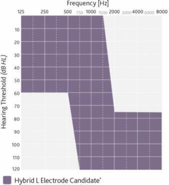 ID25-Cochlear-Nucleus-Hybrid-Implant-System-Candidacyhybrid-candidacy-chart.jpg